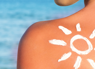 Au secours ! J'ai un coup de soleil !